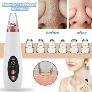 Acne Pimple Blackhead Remover Suction Device