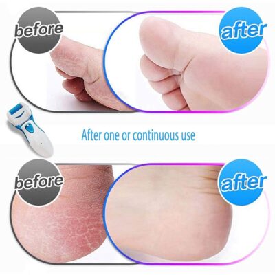 Pedi Feet Care Sander for Cracked Heels and Hard Skin. - Image 3