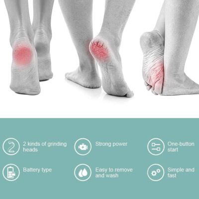 Electric Callus Remover For Feet - Image 9