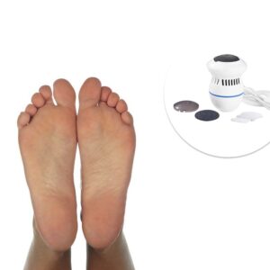 Electric Callus Remover For Feet