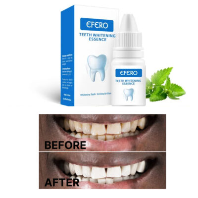 Teeth Whitening Serum - Image 3