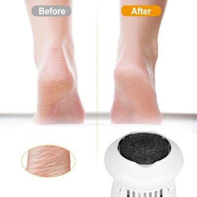 Electric Callus Remover For Feet - Image 8