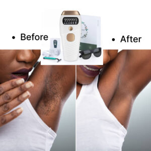 Permanent Hair Removal Laser Device