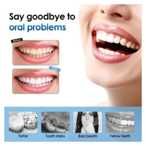 Electric Teeth Cleaner and Sonic Toothbrush Kit